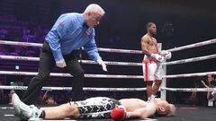 Відомий боксер втратив пам'ять після нокауту у бою за титул чемпіон світу